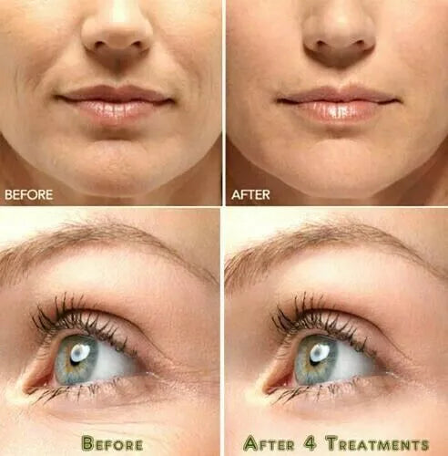 Vitamin C & Hyaluronic Acid Anti-Aging Serum Anti Aging Cream Face ,Eye Wrinkle