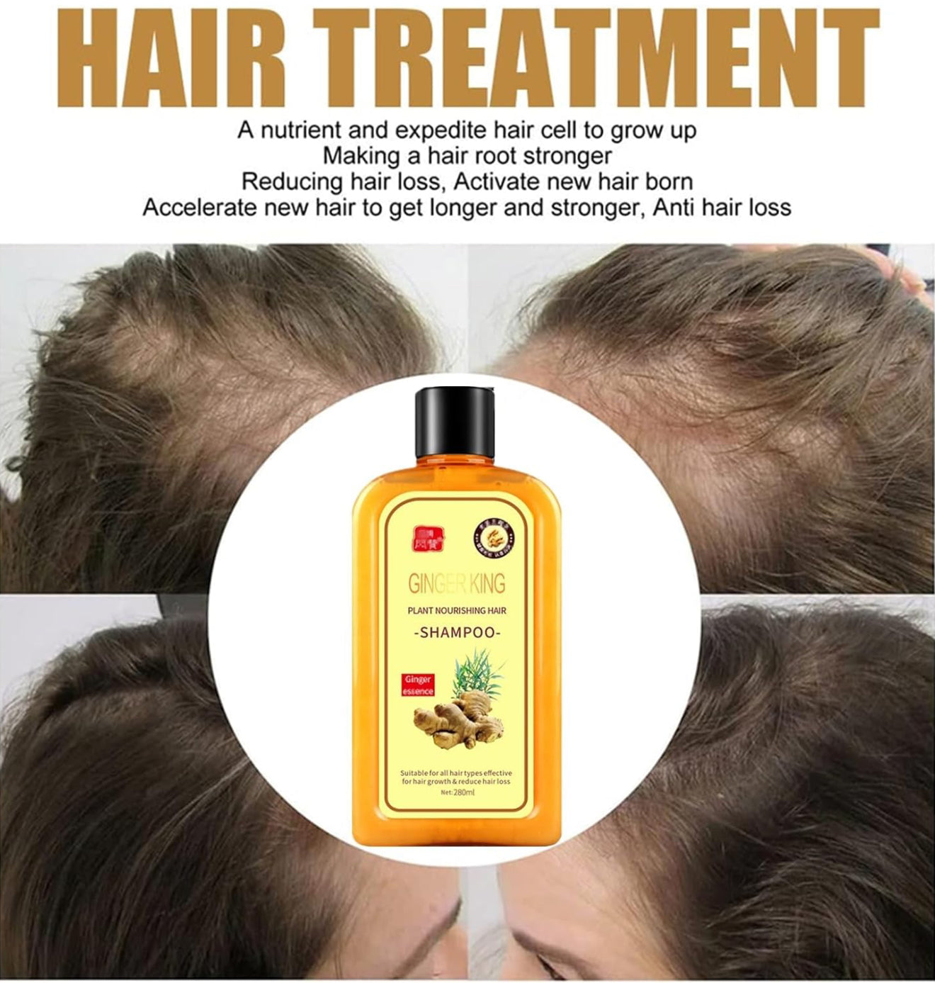 Ginger Shampoo for Hair Growth, Instant Regrowth , Anti-Fall , Care , Anti-Hair Loss (yellow, 280ML) Hair growth Shampoo .