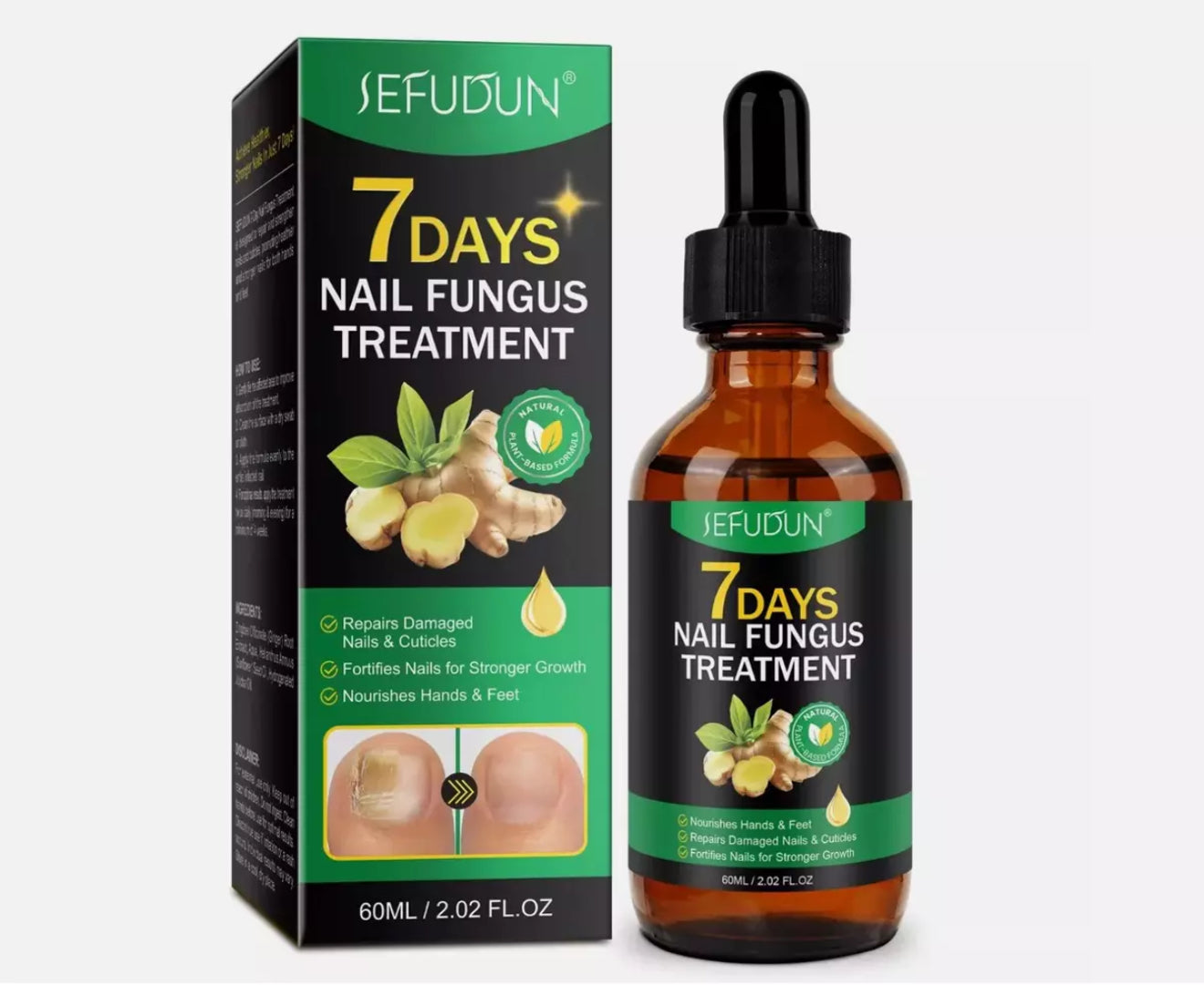 7-Day Toenail Fungus Treatment – Extra Strength Repair for Discolored Nails 30ml