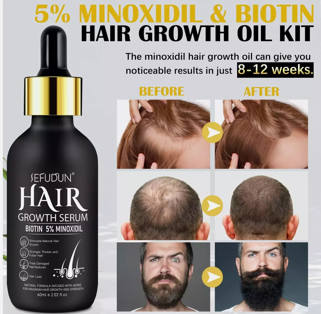 5% Minoxidil Beard Growth Oil + Derma Roller Hair Growth Serum Biotin &Collagen