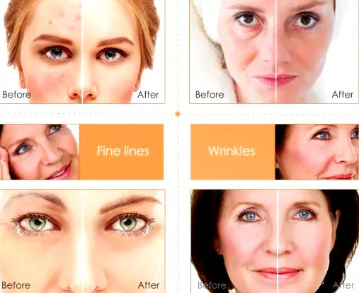 Vitamin C & Hyaluronic Acid Anti-Aging Serum Anti Aging Cream Face ,Eye Wrinkle