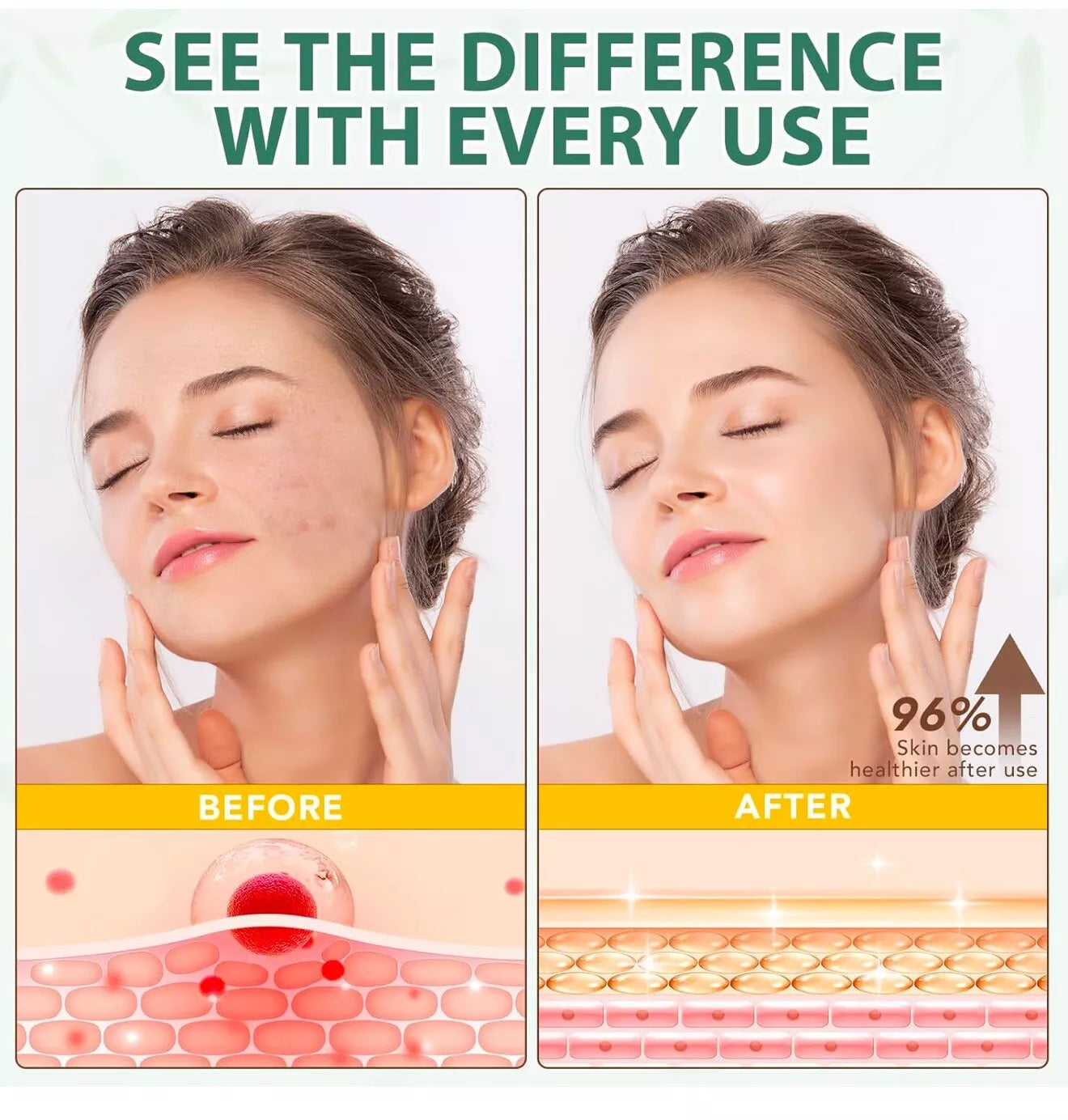 Beef Tallow for Skin -Organic Grass-Fed Whipped Beef Tallow and Honey Balm - De