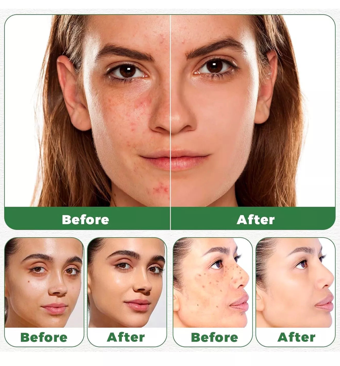 2x African Black Soap, 100% Natural for Dark spots , eczema , And Fights Acne