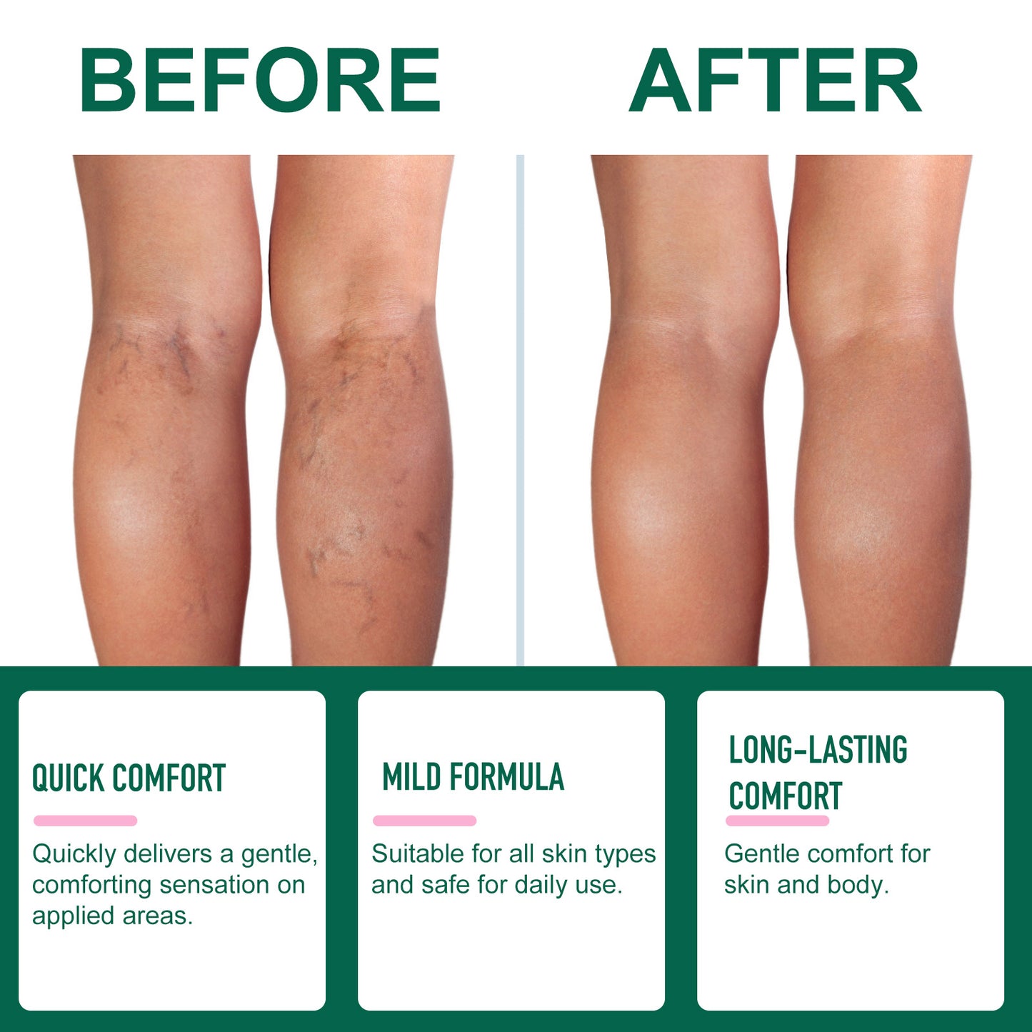 Miracle Balm - Soothing Massage Balm for Swollen Legs & Body with Arnica & Calendula - Nourishing Message Cream for Legs & Daily Care