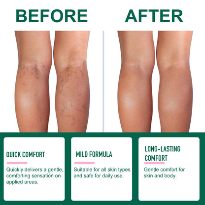 Miracle Balm - Soothing Massage Balm for Swollen Legs & Body with Arnica & Calendula - Nourishing Message Cream for Legs & Daily Care