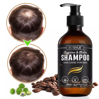 300ML Caffeine & Biotin Anti Hair Loss Shampoo Hair Growth Shampoo and Strength