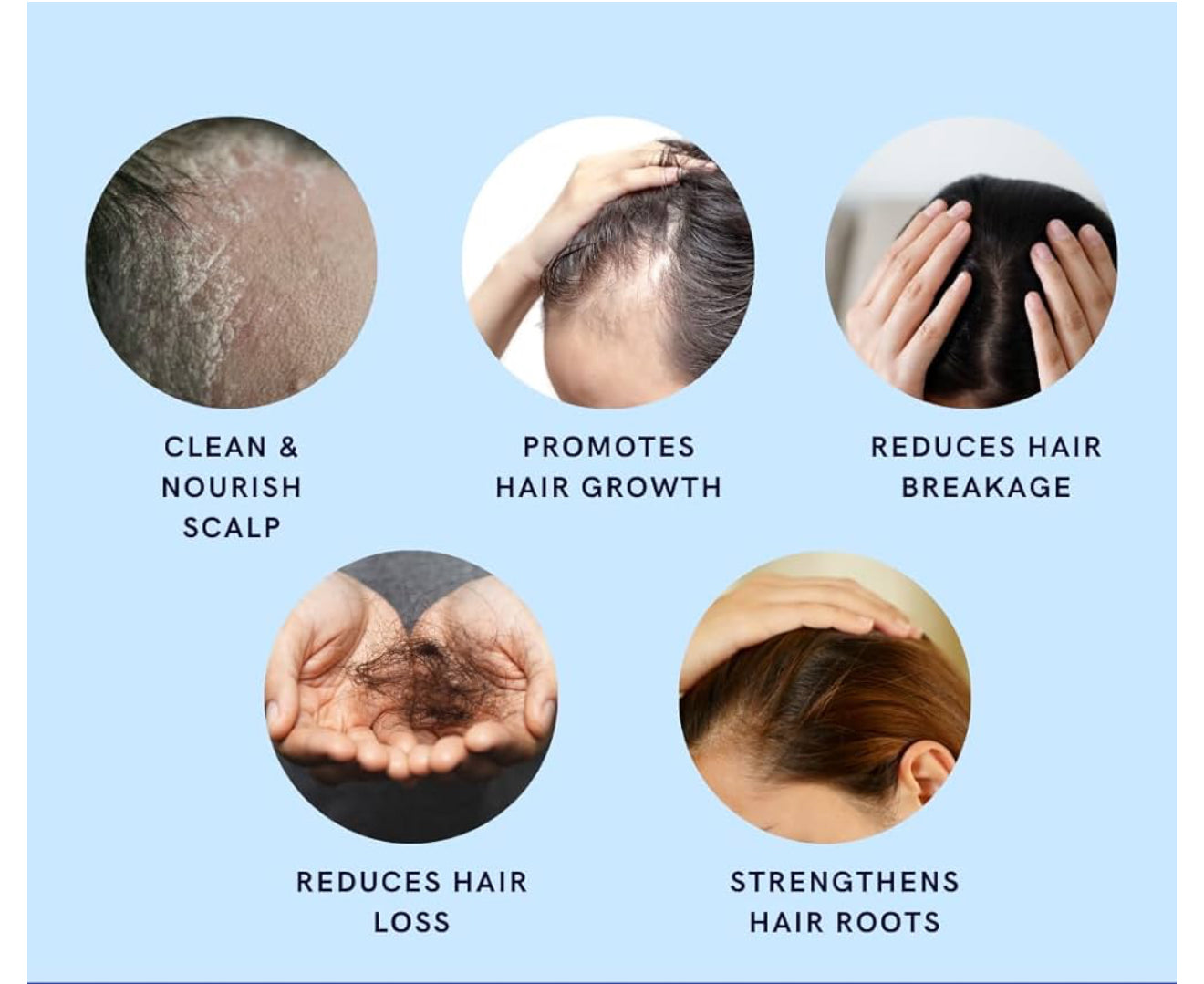 10in1 Minoxidil Shampoo with Saw palmetto ( DHT Blocker) Rosemary oil, Bergamot , Keratin , Argan , Collegen & Biotin 500ML Hair growth shampoo, stops hair loss , root activator