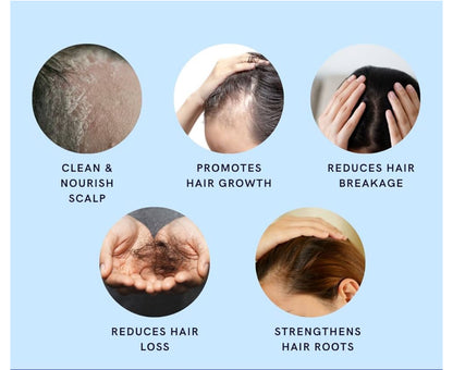 10in1 Minoxidil Shampoo with Saw palmetto ( DHT Blocker) Rosemary oil, Bergamot , Keratin , Argan , Collegen & Biotin 500ML Hair growth shampoo, stops hair loss , root activator