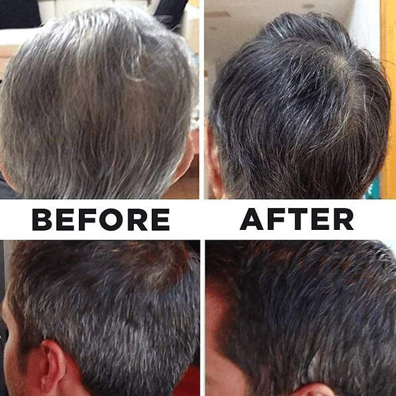 MOKERU BLACK HAIR DYE CREAM Black Hair Dye Shampoo 100% Gray Coverage