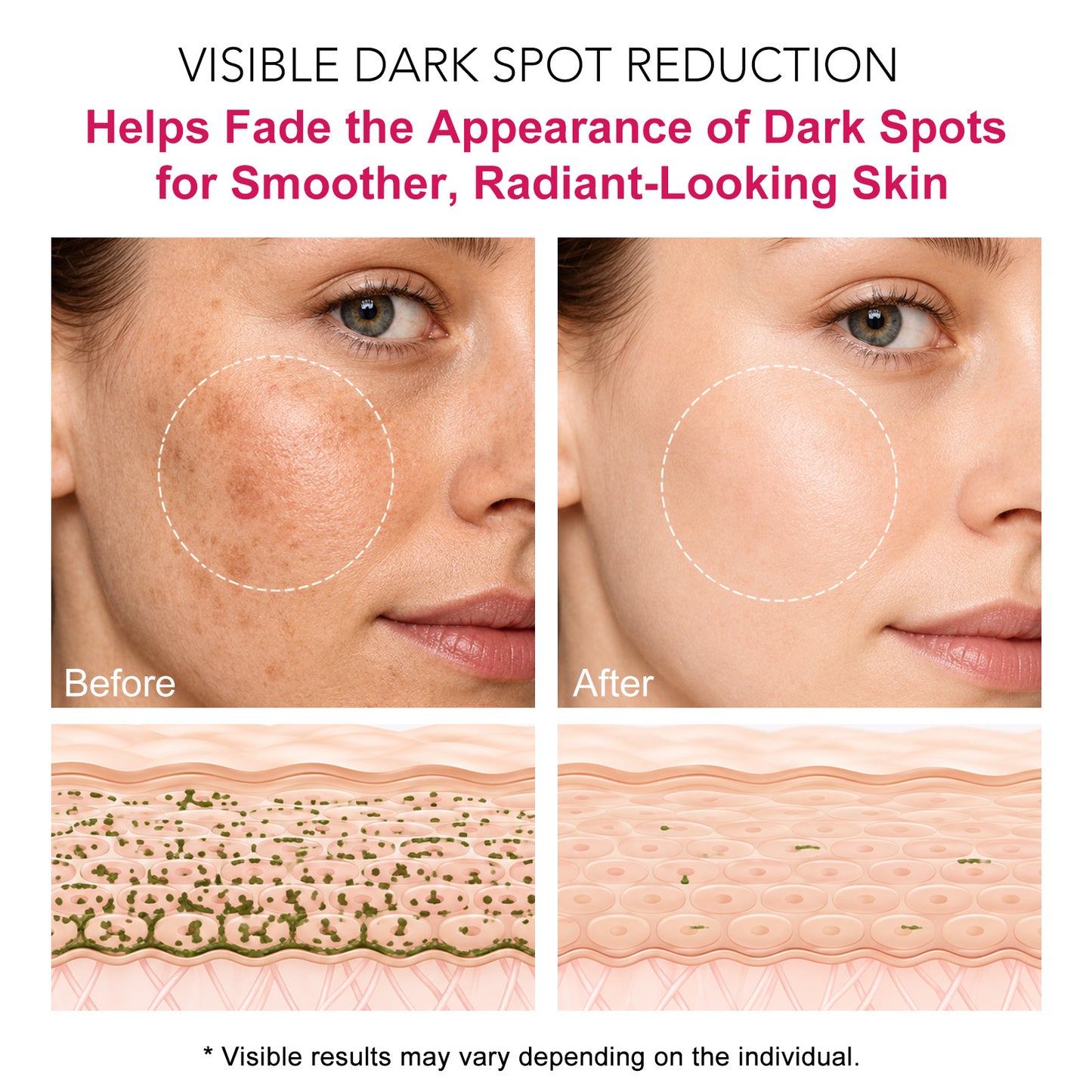 Arbutin 7% + 4% Tranexamic Acid Cream, Facial Cream for Niacinamide, Hydrating Arbutin Moisturizer, Reduce Dark Spots, Pigmentation & Blemishes for Even Tone, 120ml