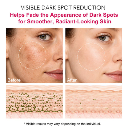 Arbutin 7% + 4% Tranexamic Acid Cream, Facial Cream for Niacinamide, Hydrating Arbutin Moisturizer, Reduce Dark Spots, Pigmentation & Blemishes for Even Tone, 120ml