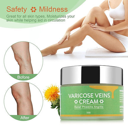 Varicose Veins Cream, Varicose Vein Soothing Leg Cream, Relief Phlebitis Vein