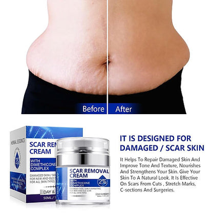 Scar Cream, Scar Removal Cream - Advanced Scar Treatment Gel for Surgical Scars,