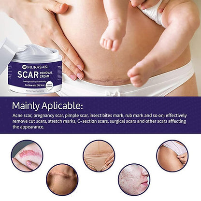 Scar Cream, Scar Removal Cream - Advanced Scar Treatment Gel for Surgical Scars,