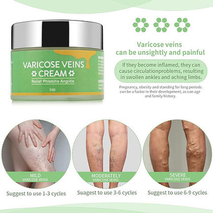 Varicose Veins Cream, Varicose Vein Soothing Leg Cream, Relief Phlebitis Vein