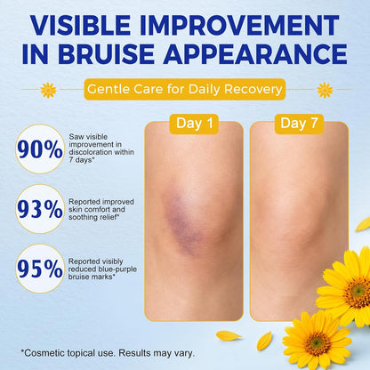 Arnica Bruise Cream w/Arnica Montana,Vitamin K,C, E Hydrating Skin,4.23oz