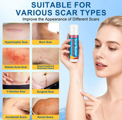 5in1 Scar Butter Cream with Vitamin E Coco shea  butter and Coconut oil helps skin recovery Scar Removal Gel with for Keloid Bump Scar Section Burns Daily Gentle Skincare Moisturizer for Women