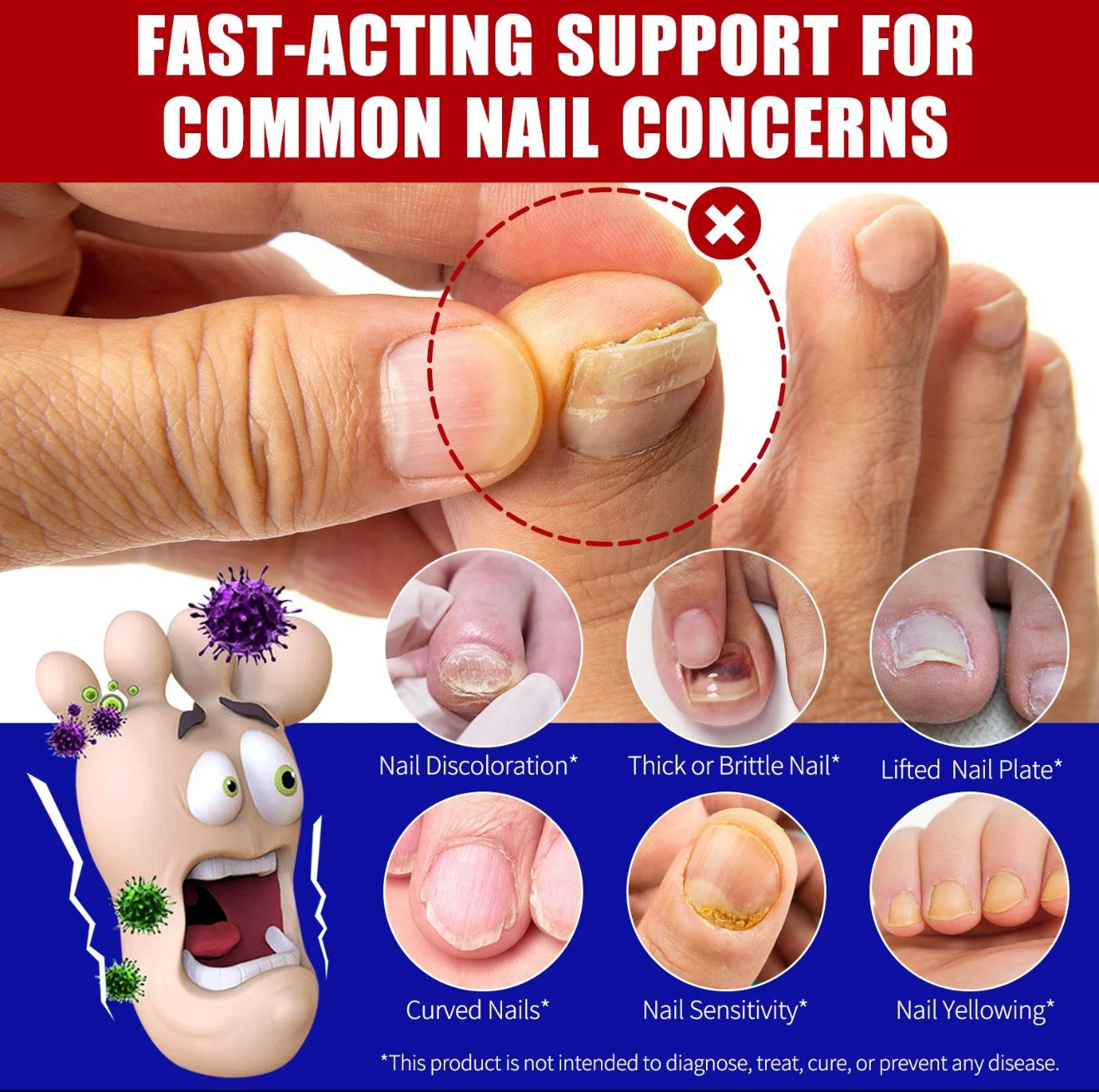 32PCS Nail Fungus Treatment For Toenails Nail Repair & Fungal Patches + OIL SET