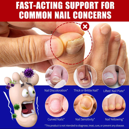 32PCS Nail Fungus Treatment For Toenails Nail Repair & Fungal Patches + OIL SET