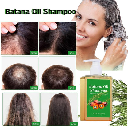 Batana Oil Shampoo with Rosemary oil shampoo Promote Hair Growth, Reduce Hairloss,Strengthening, and Cleansing -10.14Oz(300ml) .