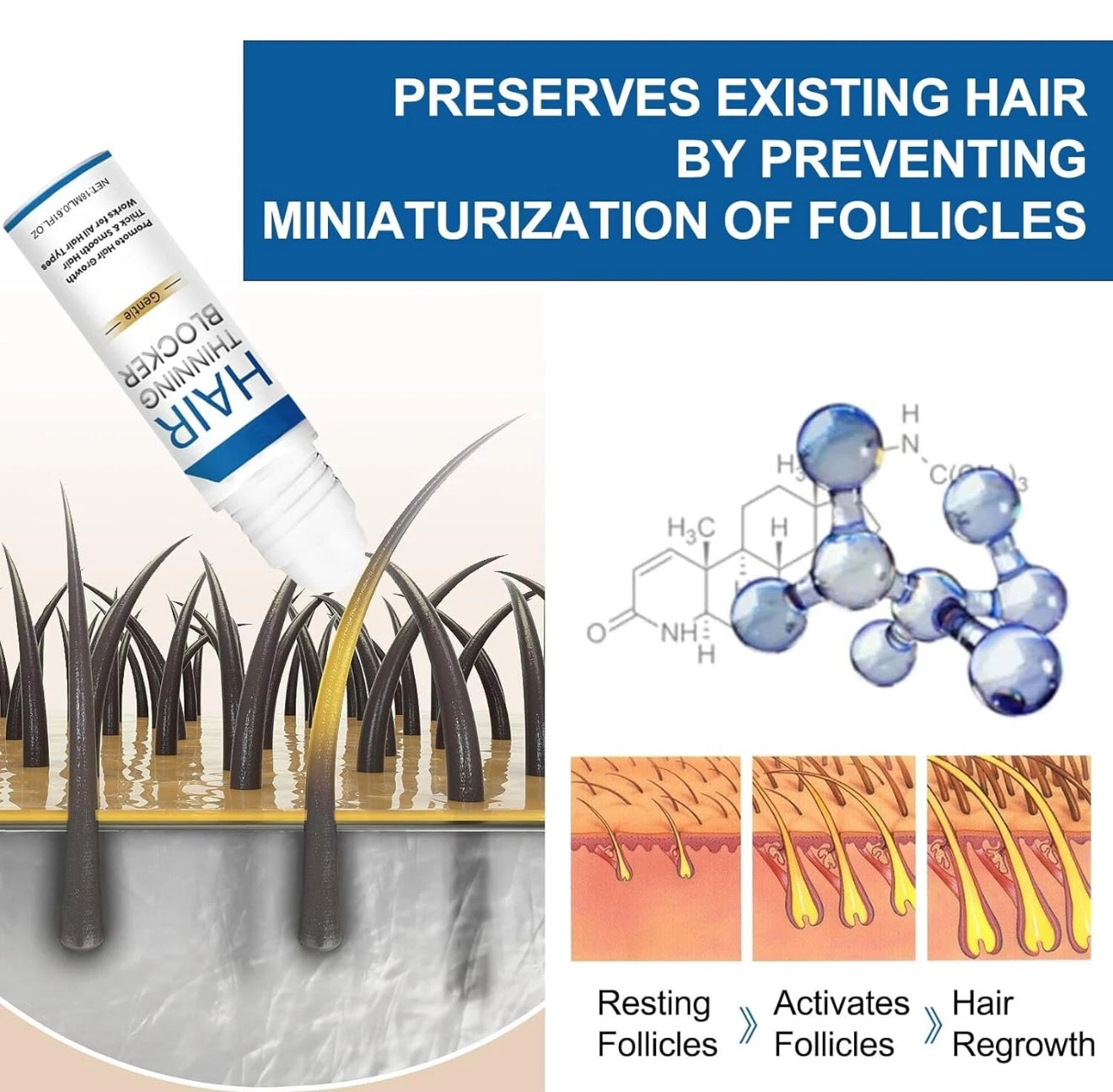 Genthair DHT 𝐁𝐥𝐨𝐜𝐤𝐞𝐫 for Men, Genthair Hair Growth Roller, Genthair DHT 𝐁𝐥𝐨𝐜𝐤𝐞𝐫 Roll On for Men, Gent Hair DHT Blocker.