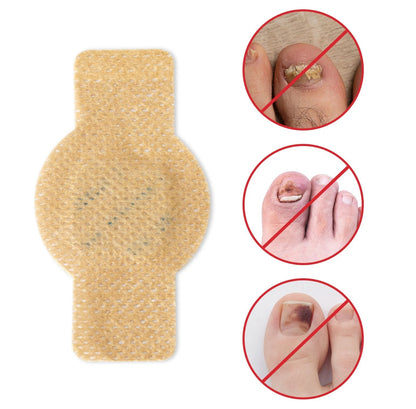 Toenail Fungus Treatment Extra Strength - Best nail fungus treatment for fingernails, nail repair, toenail softener, yellow toenail treatment, ingrown nail and foot fungus treatment extra strength