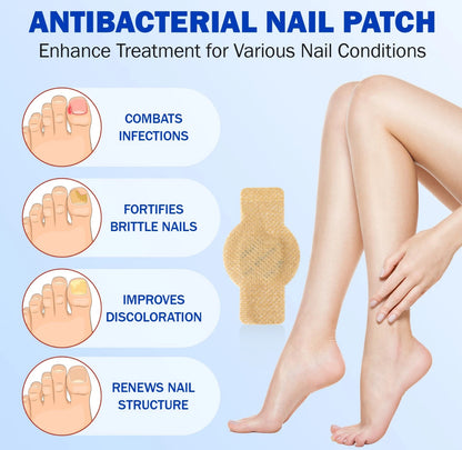 Toenail Fungus Treatment Extra Strength - Best nail fungus treatment for fingernails, nail repair, toenail softener, yellow toenail treatment, ingrown nail and foot fungus treatment extra strength